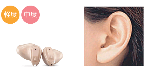 CIC耳あな型補聴器